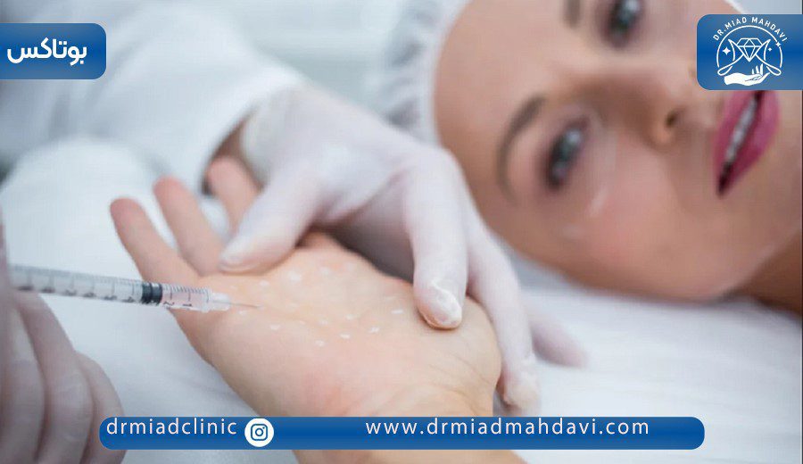 همه چیز درباره بوتاکس کف دست برای تعریق 5 بوتاکس کف دست و نقاط تزریق