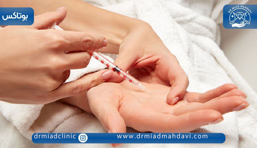 همه چیز درباره بوتاکس کف دست برای تعریق 4 بوتاکس کف دست