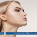 لیفت با نخ در کلینیک زیبایی، پوست و مو دکتر میعاد مهدوی