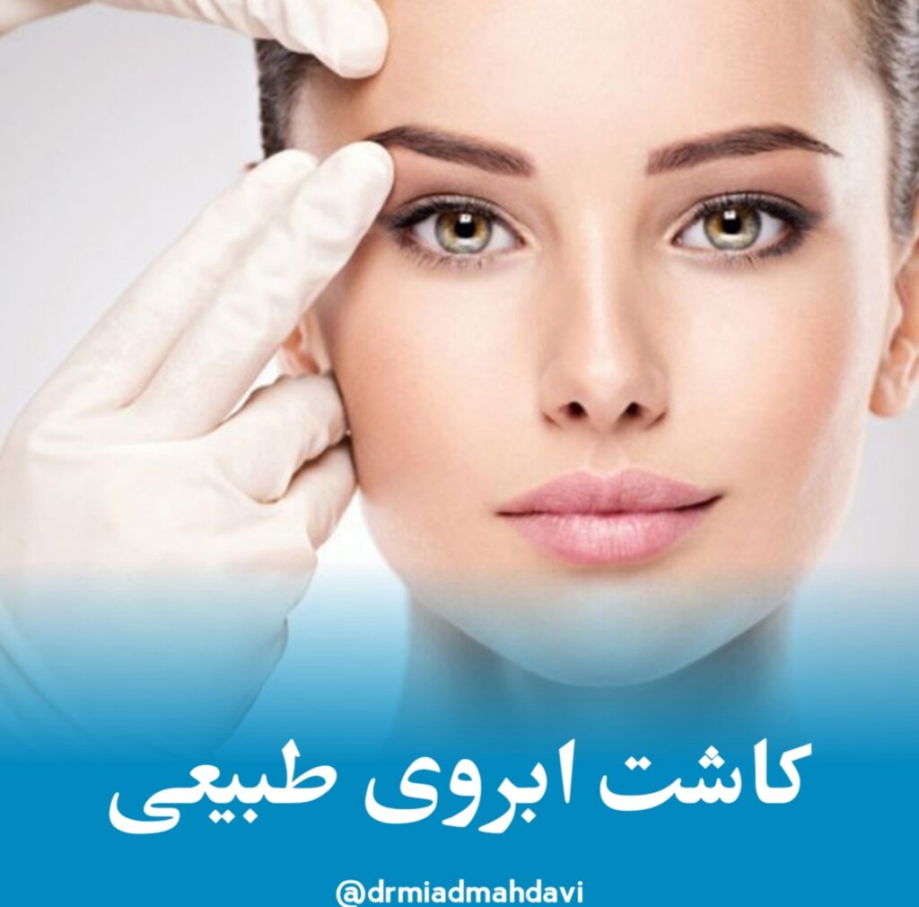 کاشت ابروی طبیعی 22 کاشت ابروی طبیعی