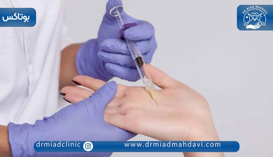همه چیز درباره بوتاکس کف دست برای تعریق 6 بوتاکس برای درمان تعریق کف دست