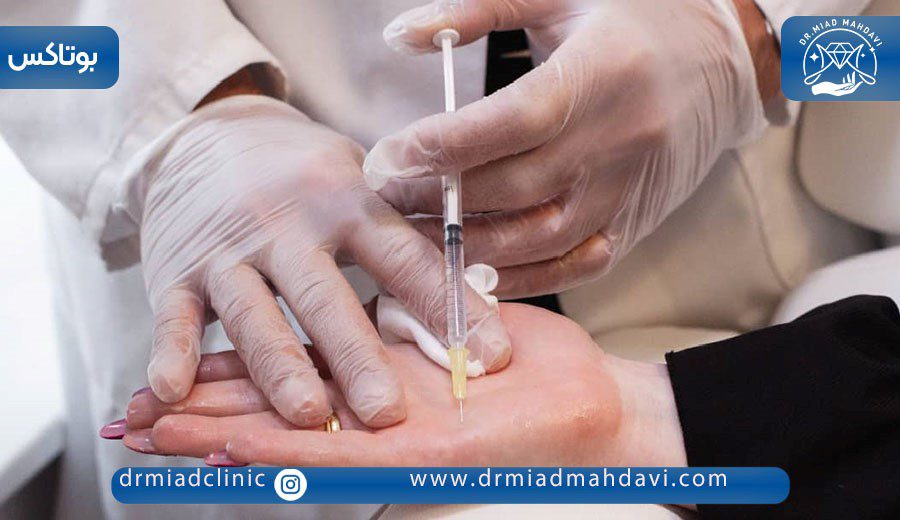 همه چیز درباره بوتاکس کف دست برای تعریق 3 تزریق بوتاکس برای هیپرهیدروز