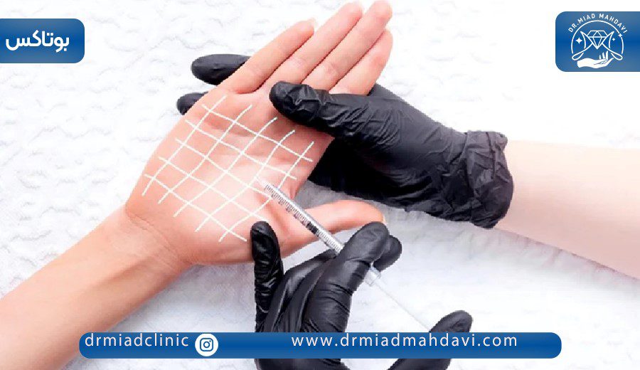 همه چیز درباره بوتاکس کف دست برای تعریق 7 تزریق بوتاکس به نواحی خاص