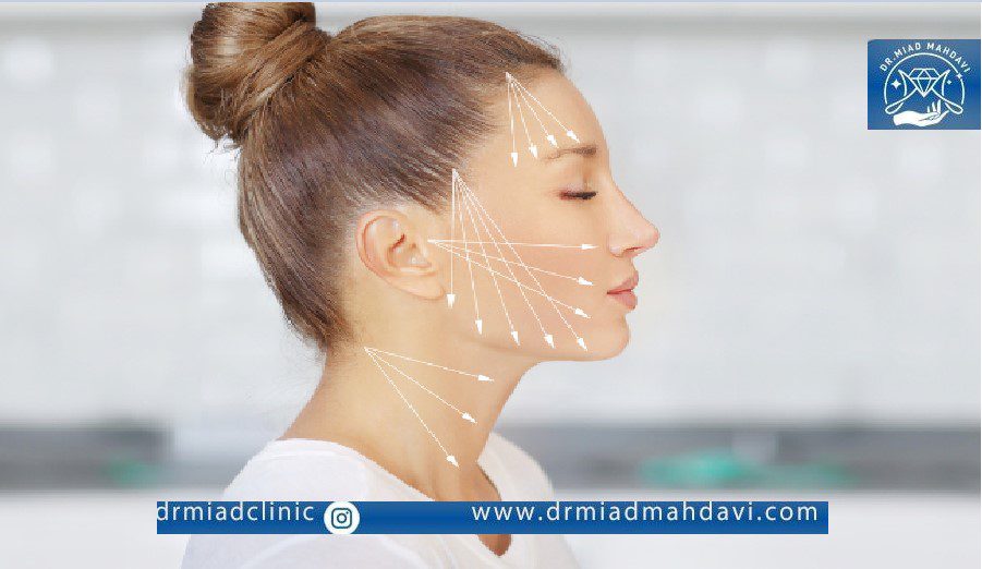 مراقبت بعد از لیفت با نخ| بهترین دکتر لیفت با نخ تهران