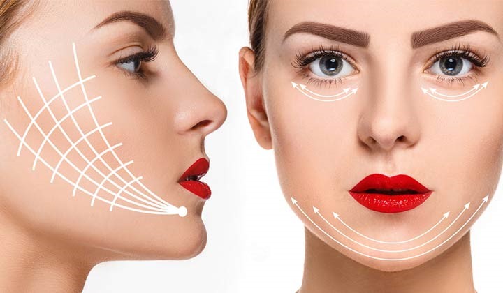مراقبت بعد از لیفت با نخ+ شرح بایدها و نبایدها 4 مراقبت های بعد از لیفت ابرو با نخ