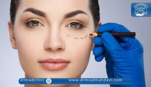 تزریق فیلر زیر چشم