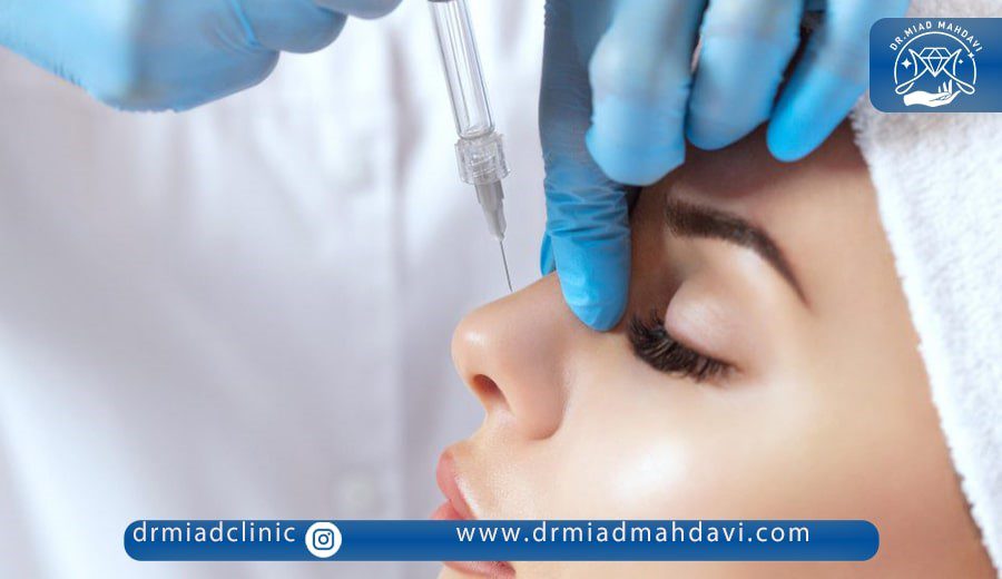 آیا فیلر بینی چروک را از بین می‌برد؟