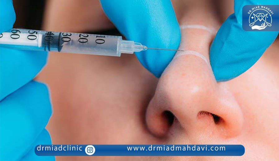 بهترین برندهای فیلر برای تزریق در ناحیه بینی