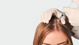 مزوتراپی مو |دکتر مزوتراپی تهران