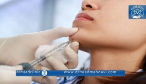فیلر چانه | دکتر میعاد مهدوی