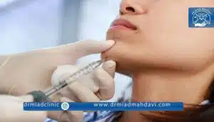 فیلر چانه | دکتر میعاد مهدوی