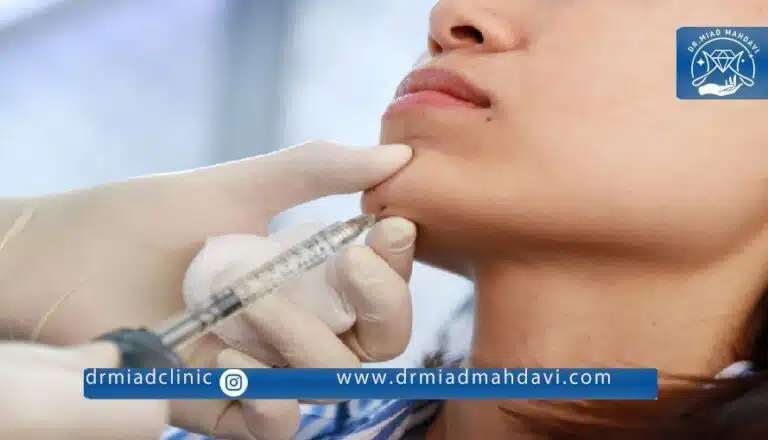 فیلر چانه | دکتر میعاد مهدوی