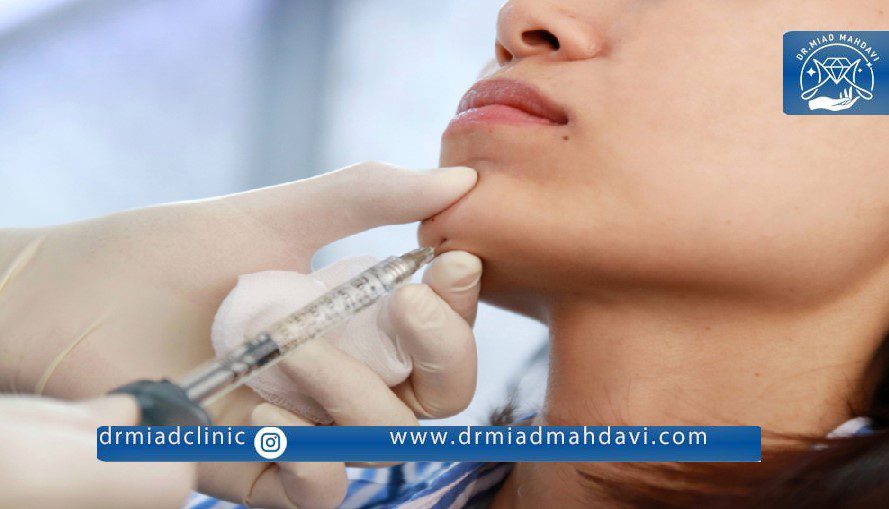 فیلر چانه | دکتر میعاد مهدوی