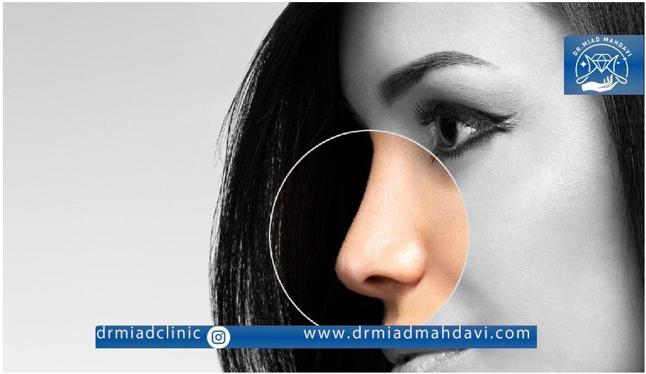 خدمات اصلاح فرم بینی