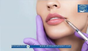 تزریق ژل لب روسی در کلینیک زیبایی دکتر میعاد مهدوی