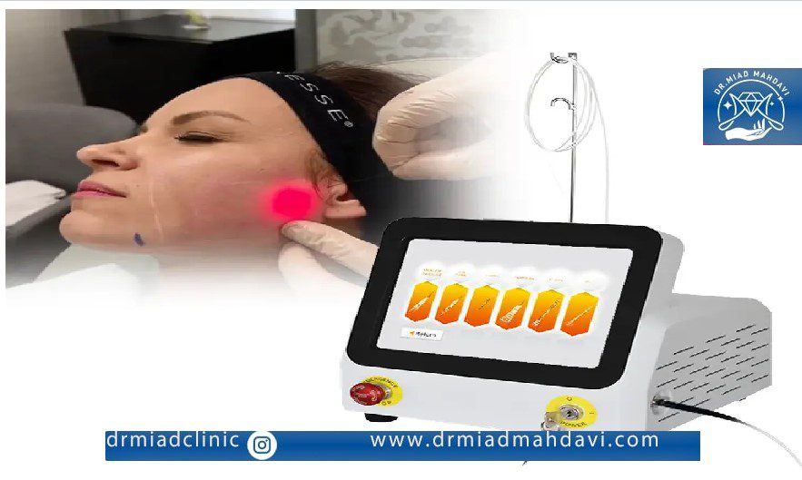 هزینه اندولیفت در تهران
