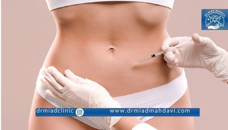 فیلر بادی |دکتر میعاد مهدوی