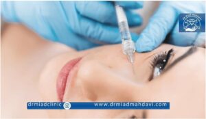 هزینه فیلر زیر چشم در کلینیک زیبایی دکتر میعاد مهدوی