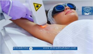 عکس لیزر زیر بغل خانم توسط اپراتور |قیمت لیزر موهای زائد بدن