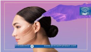 قیمت لیفت صورت با نخ چطور تعیین می شود؟|دکتر میعاد مهدوی