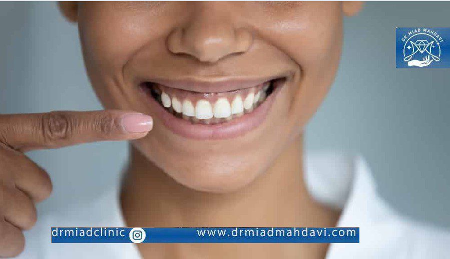 لبخند لثه ای چیست؟