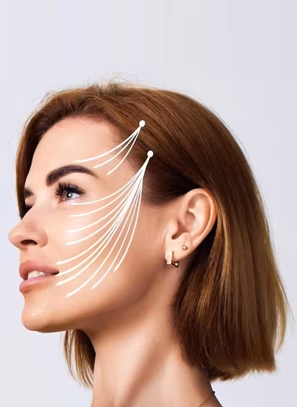 لیفت شقیقه در کلینیک زیبایی دکتر مهدوی