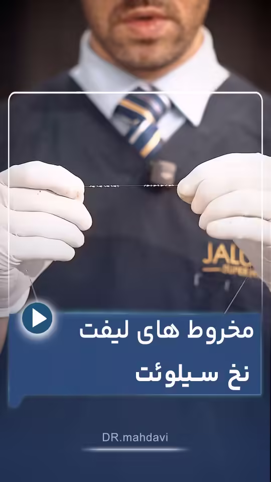 ۳ نکته کلیدی لیفت با نخ سیلوئت