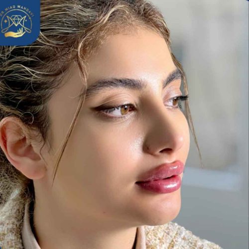 ژل لب |به سبک دکتر میعاد مهدوی